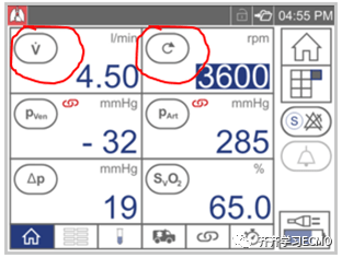 ECMO中的流量情况
