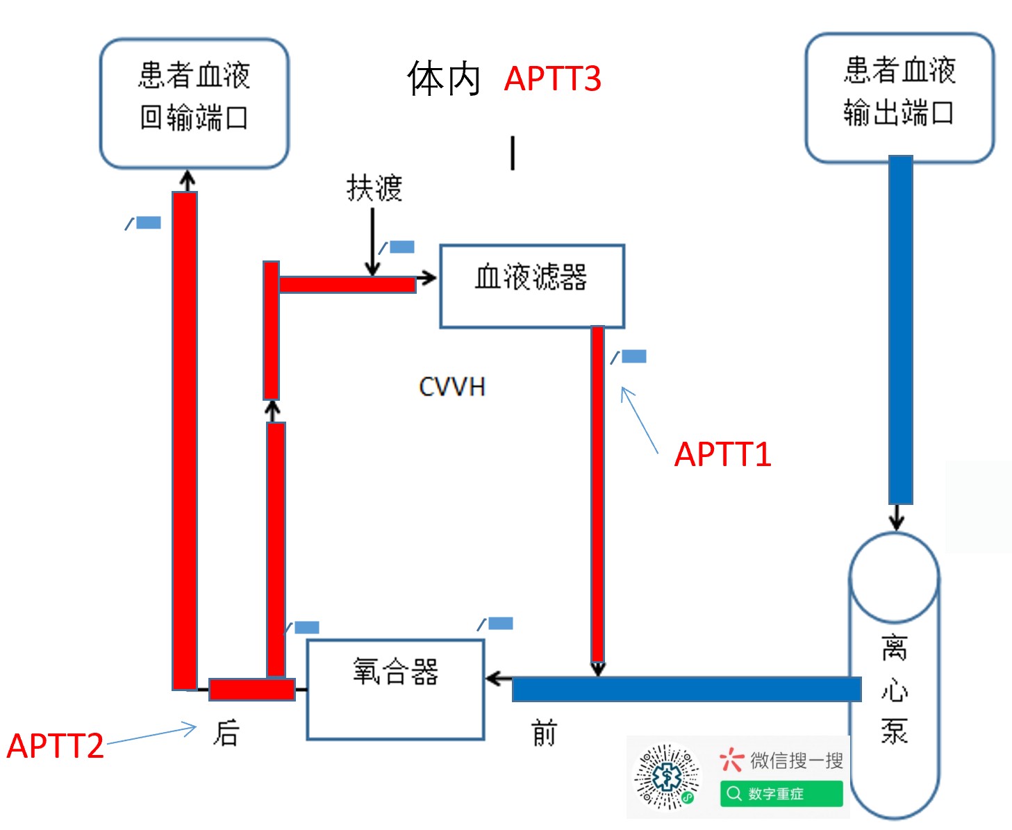 ECMO抗凝-每天半小时学会独立管理ECMO