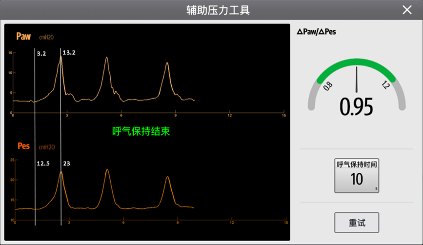 食道压等于胸腔内压吗? 食道压等于胸腔内压吗?