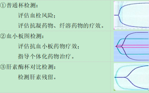 轻松读懂血栓弹力图TEG