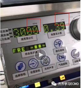 ECMO中的流量情况