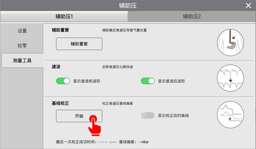 食道压等于胸腔内压吗(2)? 食道压等于胸腔内压吗(2)?
