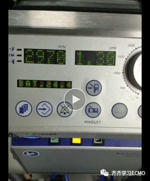 ECMO中的流量情况