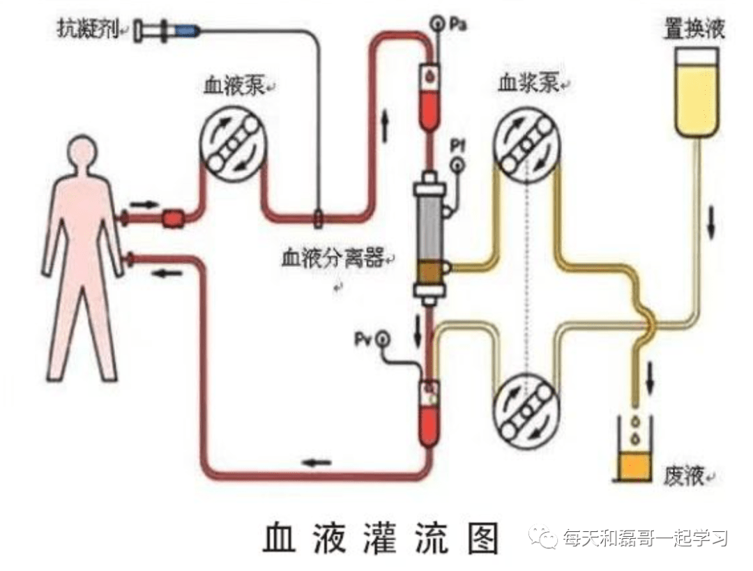 重症技术之血液净化（七）-血液净化技术分类
