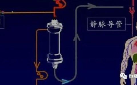 CRRT的基本原理与模式
