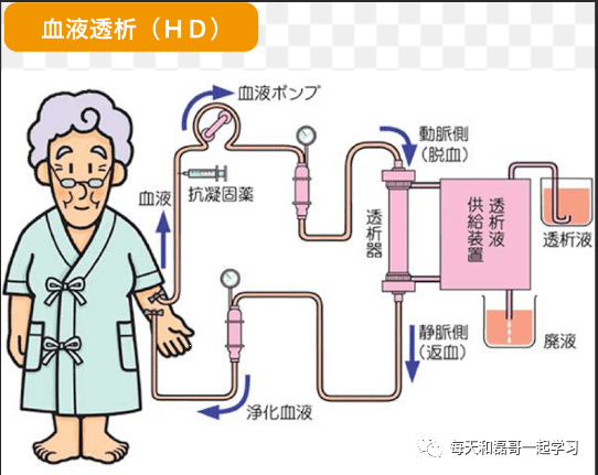 重症技术之血液净化（七）-血液净化技术分类