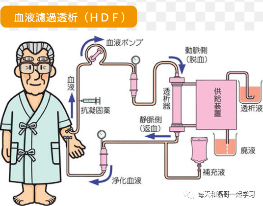 重症技术之血液净化（七）-血液净化技术分类