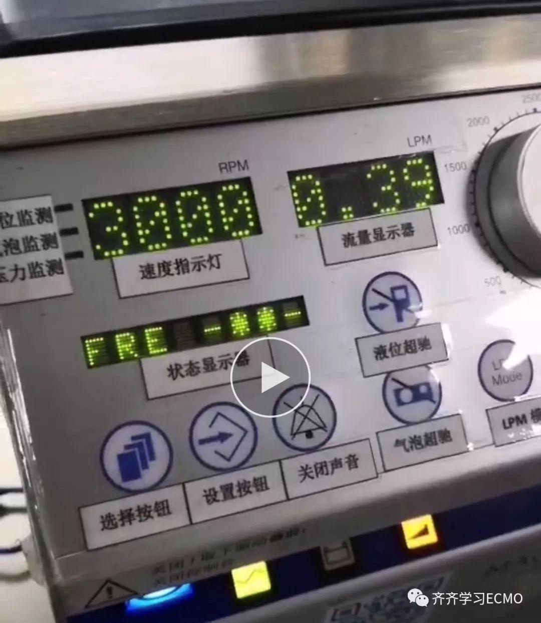 ECMO中的流量情况
