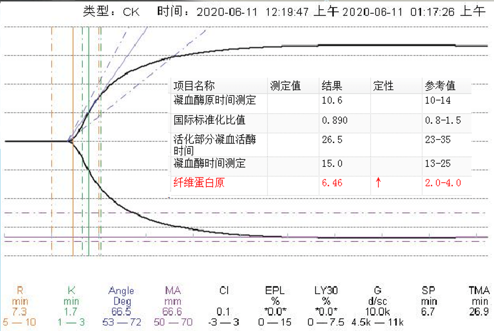 血栓弹力图在脓毒症患者中的应用