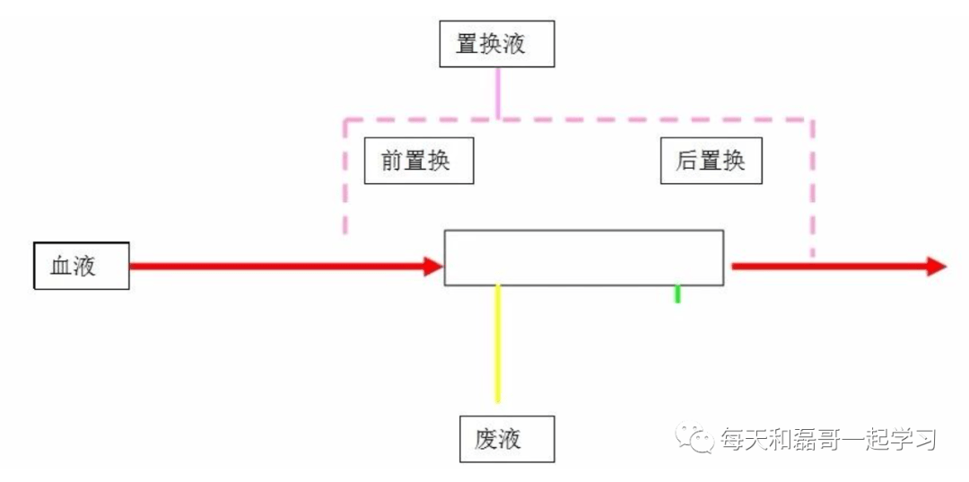 重症技术之血液净化（九）-血液净化技术-CRRT模式/滤过分数/设备