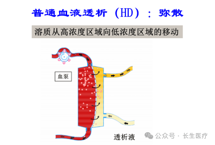 楚雄长生肾脏病医院：普通血液透析、高通量血液透析、血液透析滤过，您知道怎么选吗？