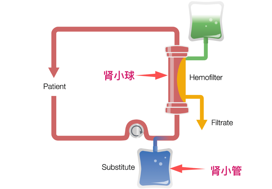 三分钟学血透——血滤原理 三分钟学血透——血滤原理