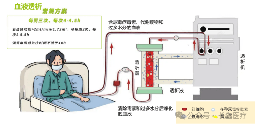 楚雄长生肾脏病医院：普通血液透析、高通量血液透析、血液透析滤过，您知道怎么选吗？