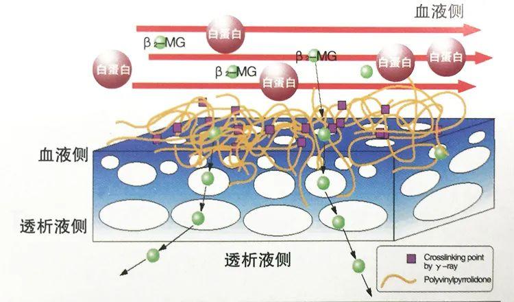 Prof.Q讲堂丨一文带你认识透析器的不同种类