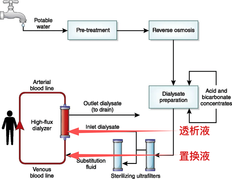 三分钟学血透——置换液