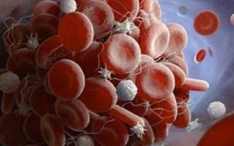 血小板无效输注诊断和治疗中国专家共识2022版