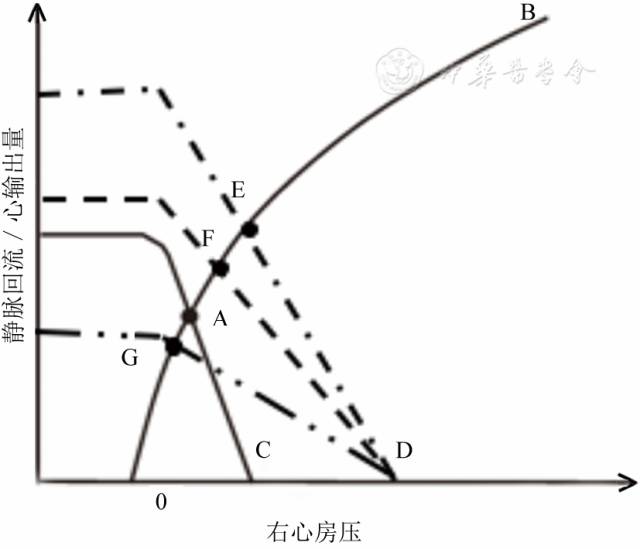 静脉回流:重症医学医师值得关注的心功能之外的问题