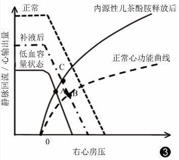 静脉回流:重症医学医师值得关注的心功能之外的问题