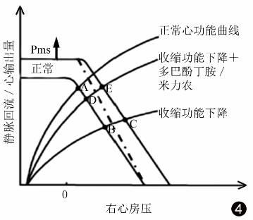 静脉回流:重症医学医师值得关注的心功能之外的问题