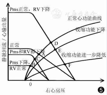 静脉回流:重症医学医师值得关注的心功能之外的问题