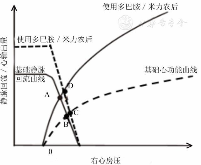 静脉回流:重症医学医师值得关注的心功能之外的问题