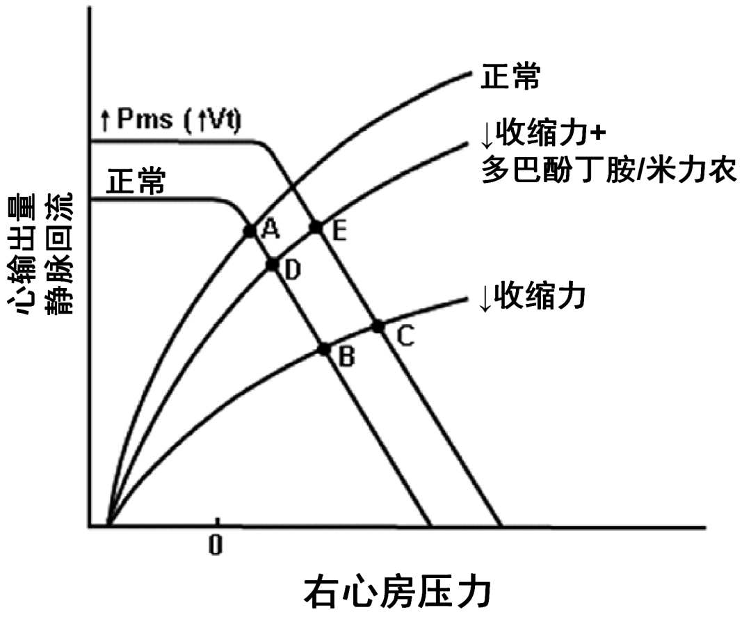 危重和休克患者静脉回流: 第二部分: 休克和机械通气