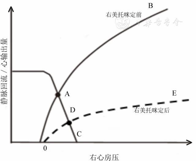 静脉回流:重症医学医师值得关注的心功能之外的问题