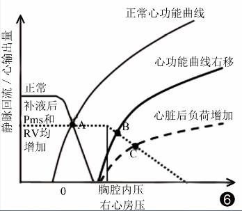静脉回流:重症医学医师值得关注的心功能之外的问题