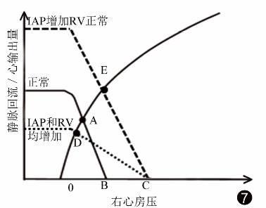 静脉回流:重症医学医师值得关注的心功能之外的问题