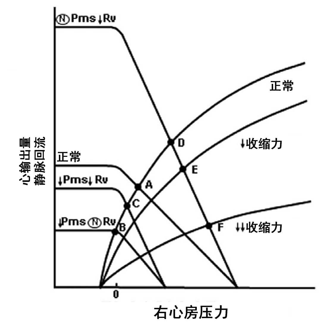 危重和休克患者静脉回流: 第二部分: 休克和机械通气