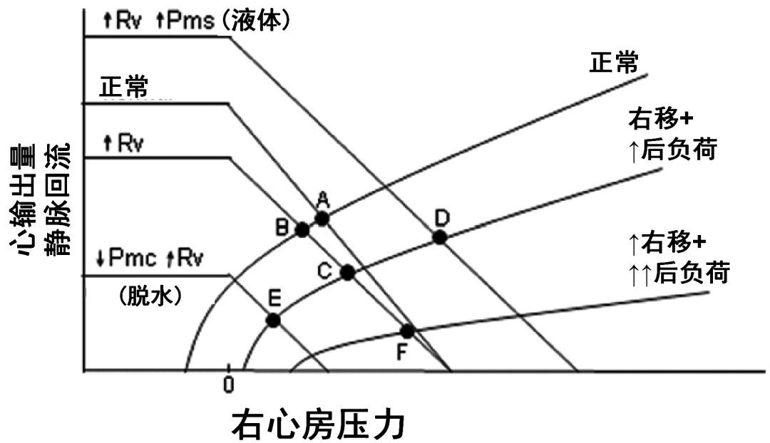 危重和休克患者静脉回流: 第二部分: 休克和机械通气