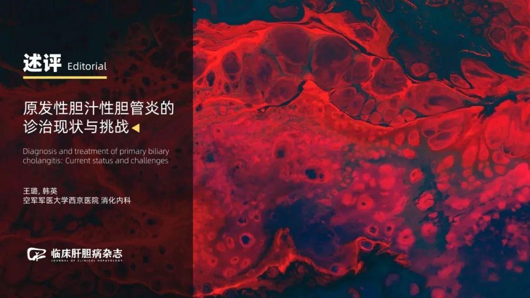 述评|韩英:原发性胆汁性胆管炎的诊治现状与挑战