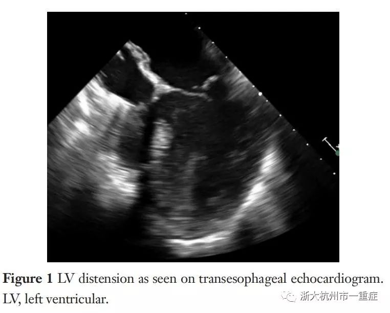 VA-ECMO患者左心室扩张VS减压策略