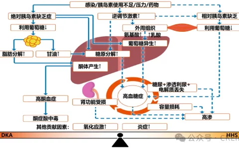 糖尿病酮症酸中毒时腹痛的潜在机制