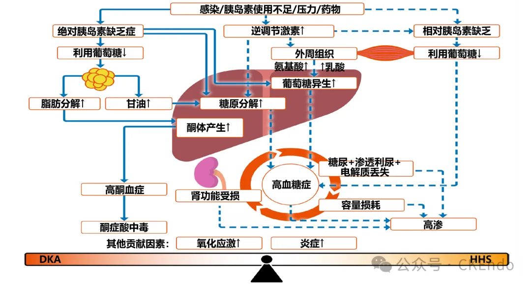 CK医学综述 l 2025糖尿病酮症酸中毒和正常血糖糖尿病酮症酸中毒(EDKA)