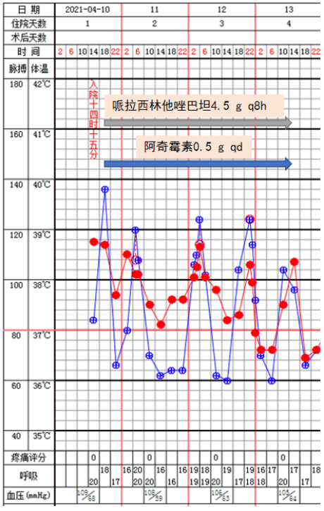 鼻病毒肺炎的诊治
