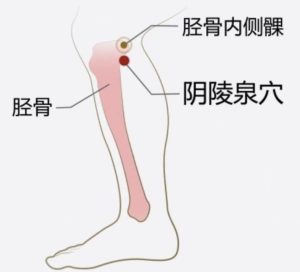 痛风物理治疗
