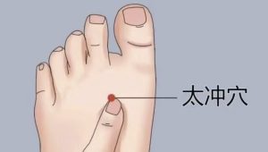 痛风物理治疗
