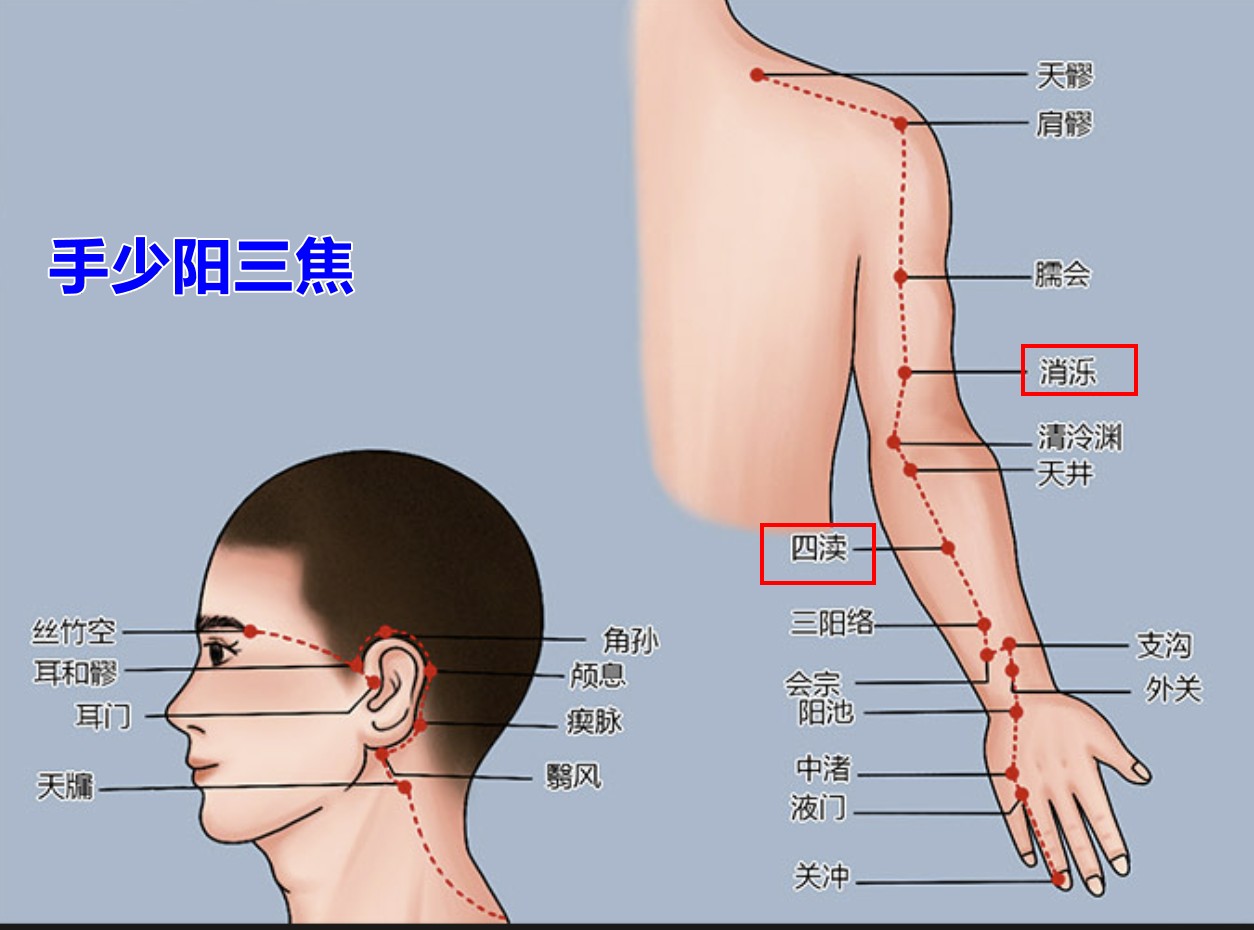 按经络敲穴位,自己搞定偏头痛