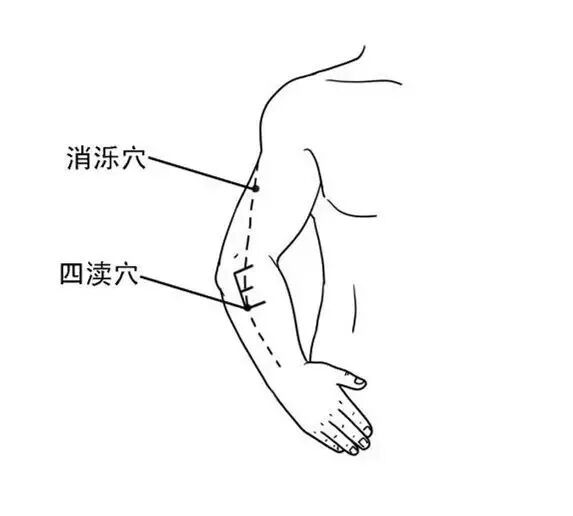 按经络敲穴位,自己搞定偏头痛