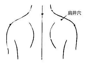 按经络敲穴位,自己搞定偏头痛